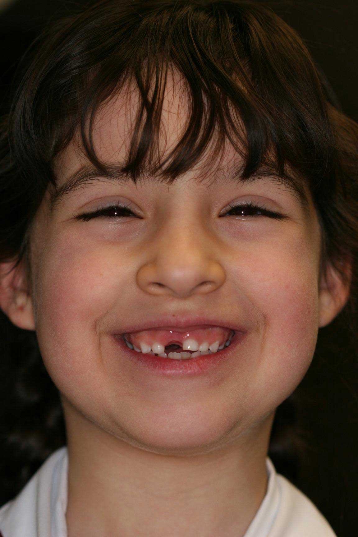 happy dental child